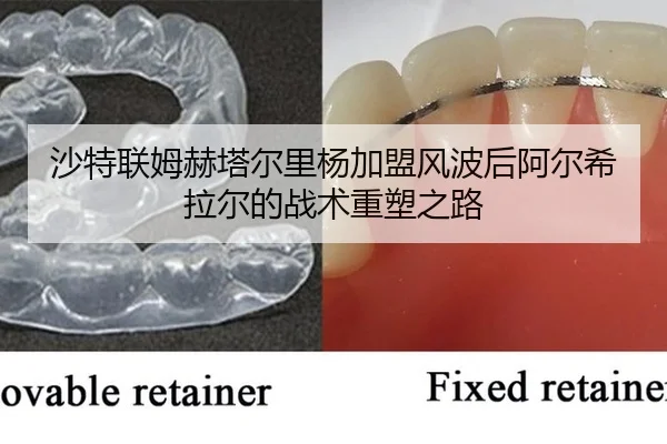 sha-te-lian-mu-he-ta-er-li-yang-jia-meng-feng-bo-hou-a-er-xi-la-er-de-zhan-shu-zhong-su-zhi-lu-2-902.jpg